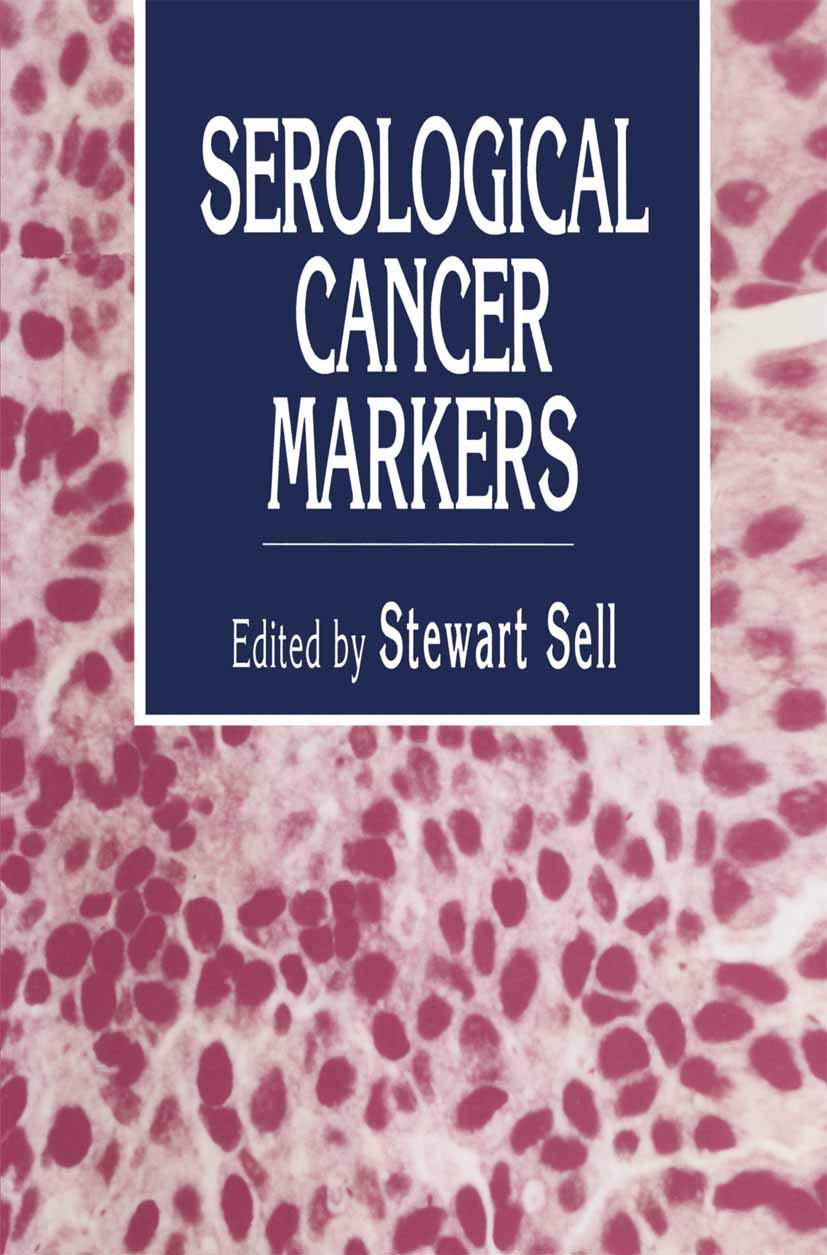 Serological Cancer Markers (Contemporary Biomedicine, 11),Used