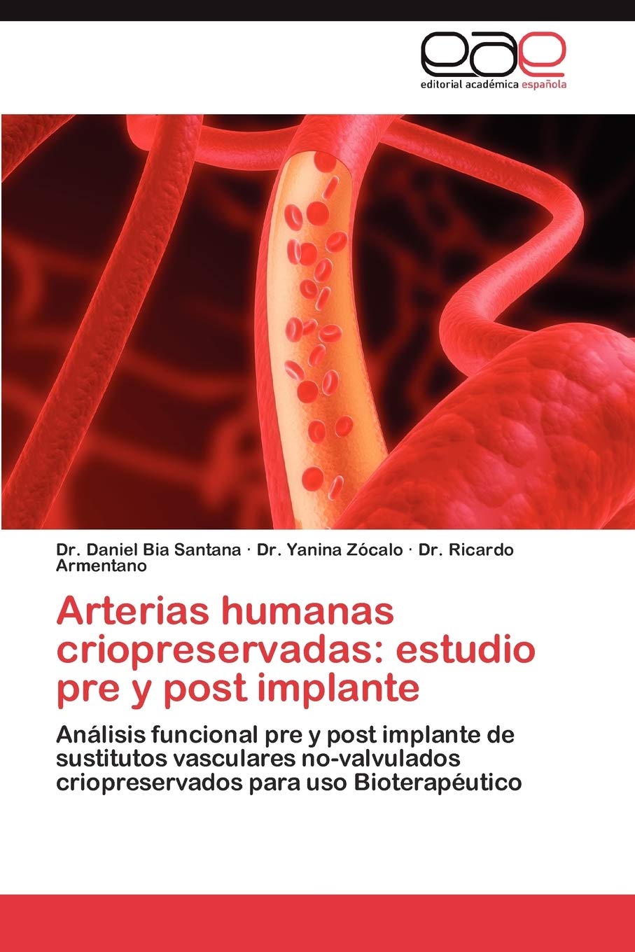 Arterias humanas criopreservadas: estudio pre y post implante: Anlisis funcional pre y post implante de sustitutos vasculares ,Used