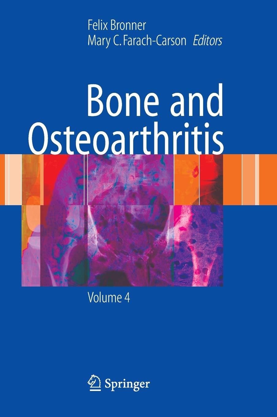 Bone and Osteoarthritis (Topics in Bone Biology, 4),New
