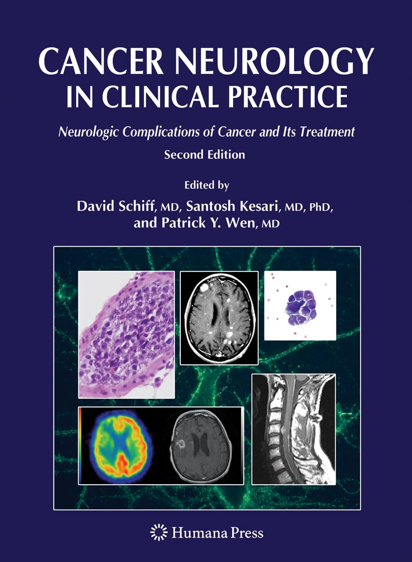Cancer Neurology in Clinical Practice: Neurologic Complications of Cancer and Its Treatment (Current Clinical Oncology),Used