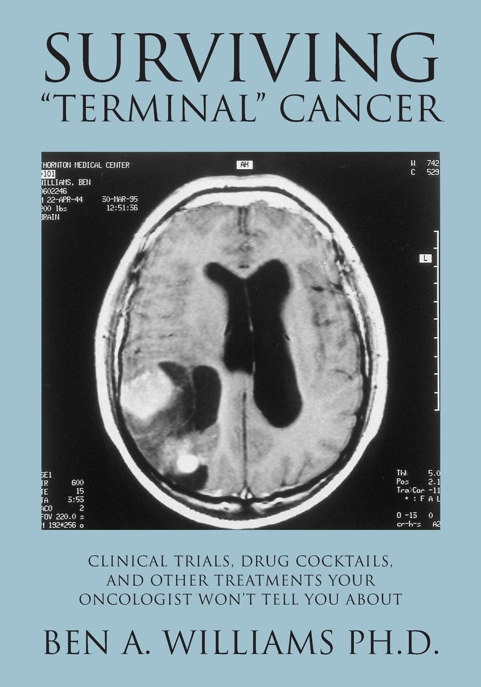 Surviving 'Terminal' Cancer: Clinical Trials, Drug Cocktails, and Other Treatments Your Oncologist Won't Tell You About,New