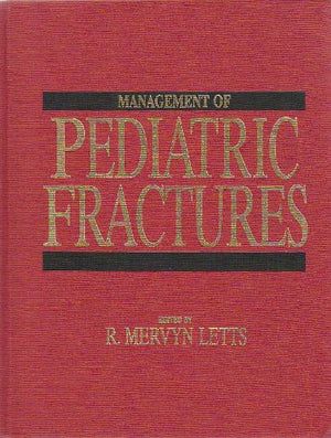 Management of Pediatric Fractures,Used