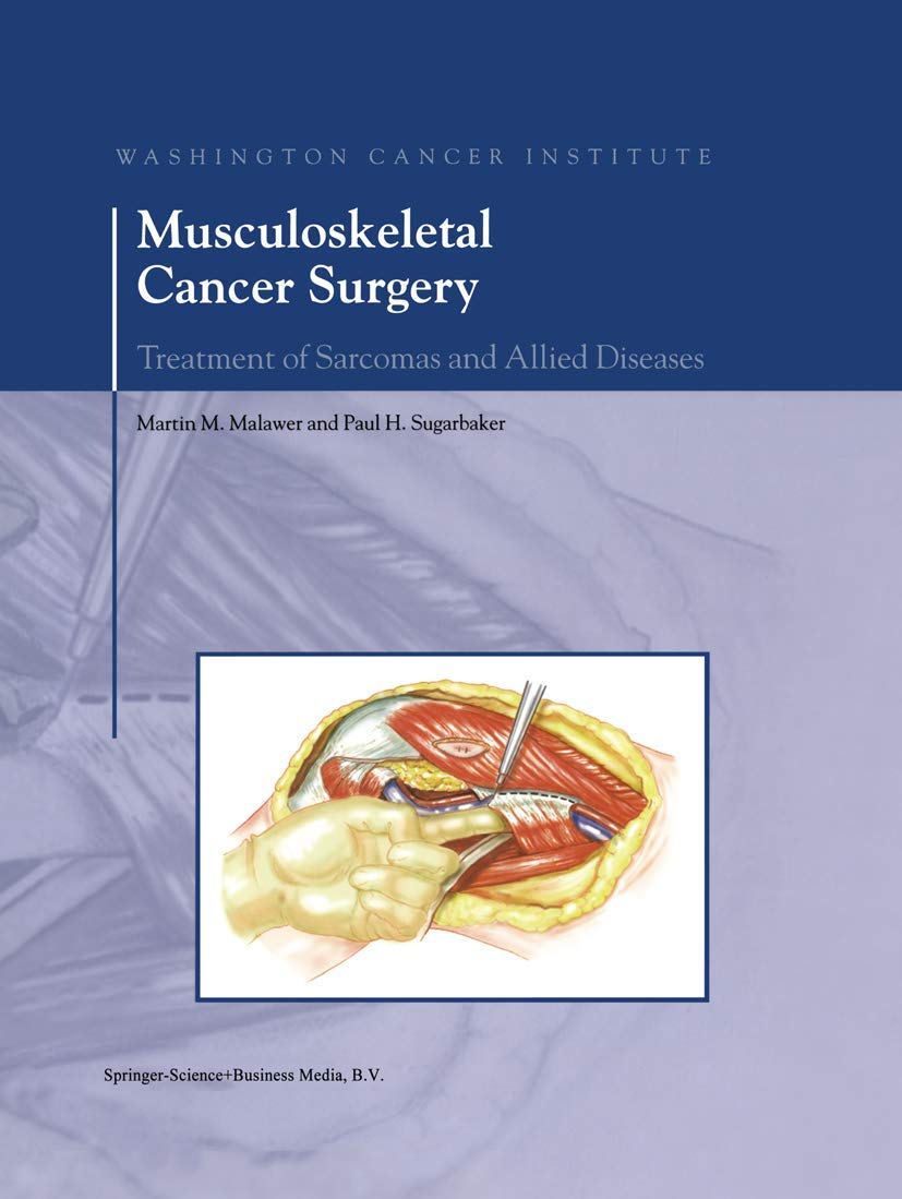 Musculoskeletal Cancer Surgery: Treatment of Sarcomas and Allied Diseases,Used