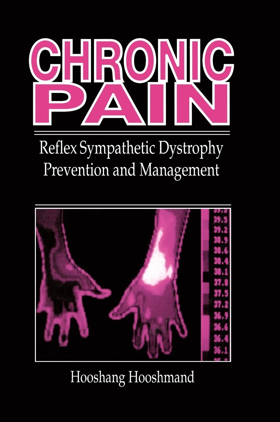 Chronic Pain: Reflex Sympathetic Dystrophy, Prevention, and Management,Used