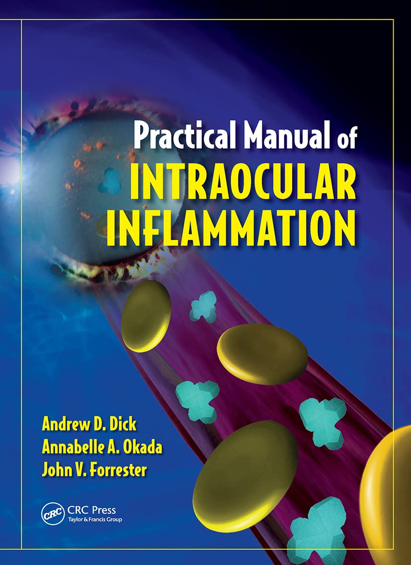 Practical Manual of Intraocular Inflammation,Used