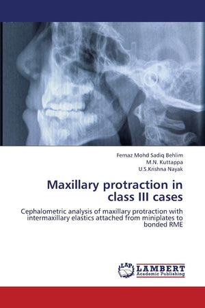 Maxillary protraction in class III cases: Cephalometric analysis of maxillary protraction with intermaxillary elastics attached ,Used