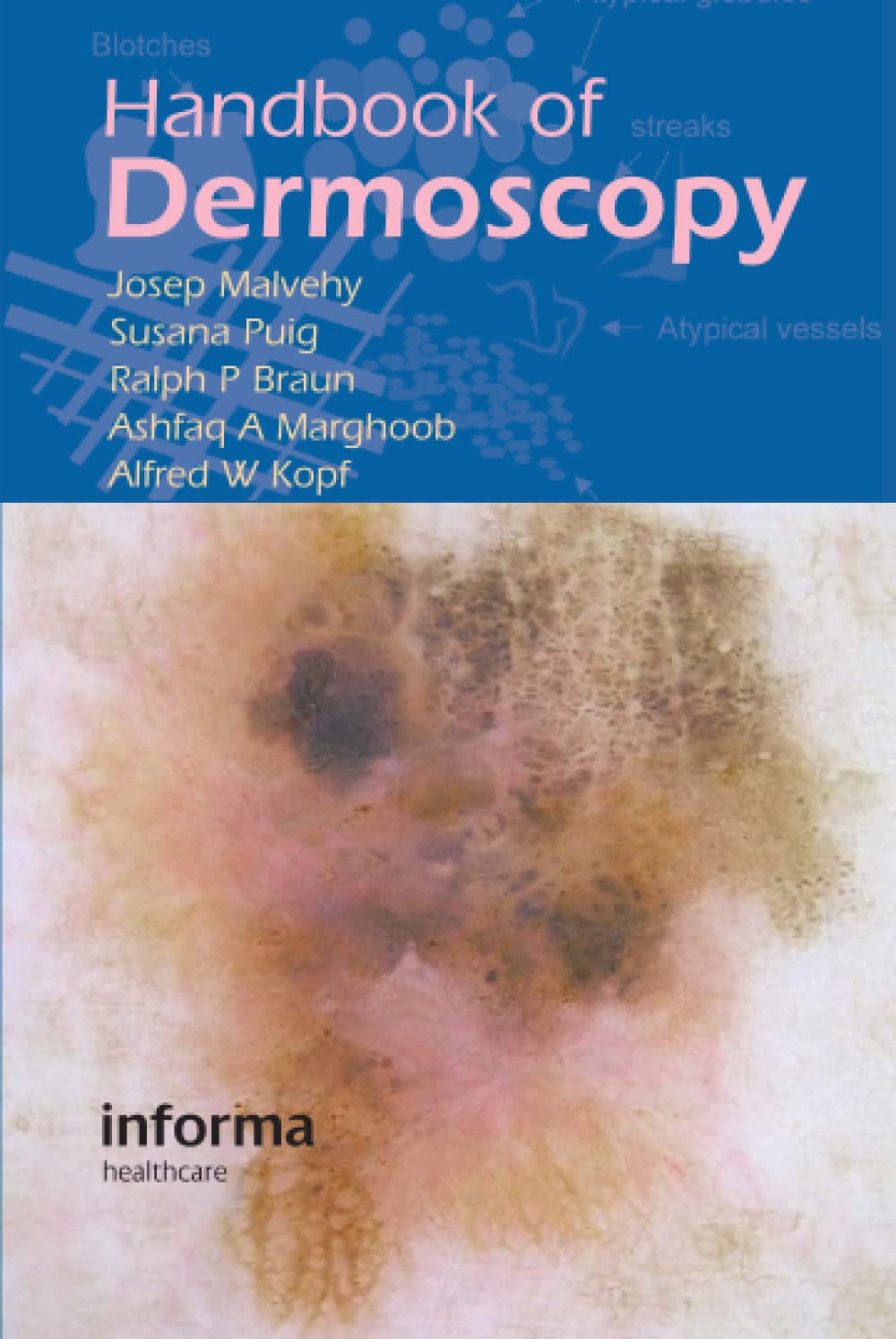 Handbook Of Dermoscopy,Used