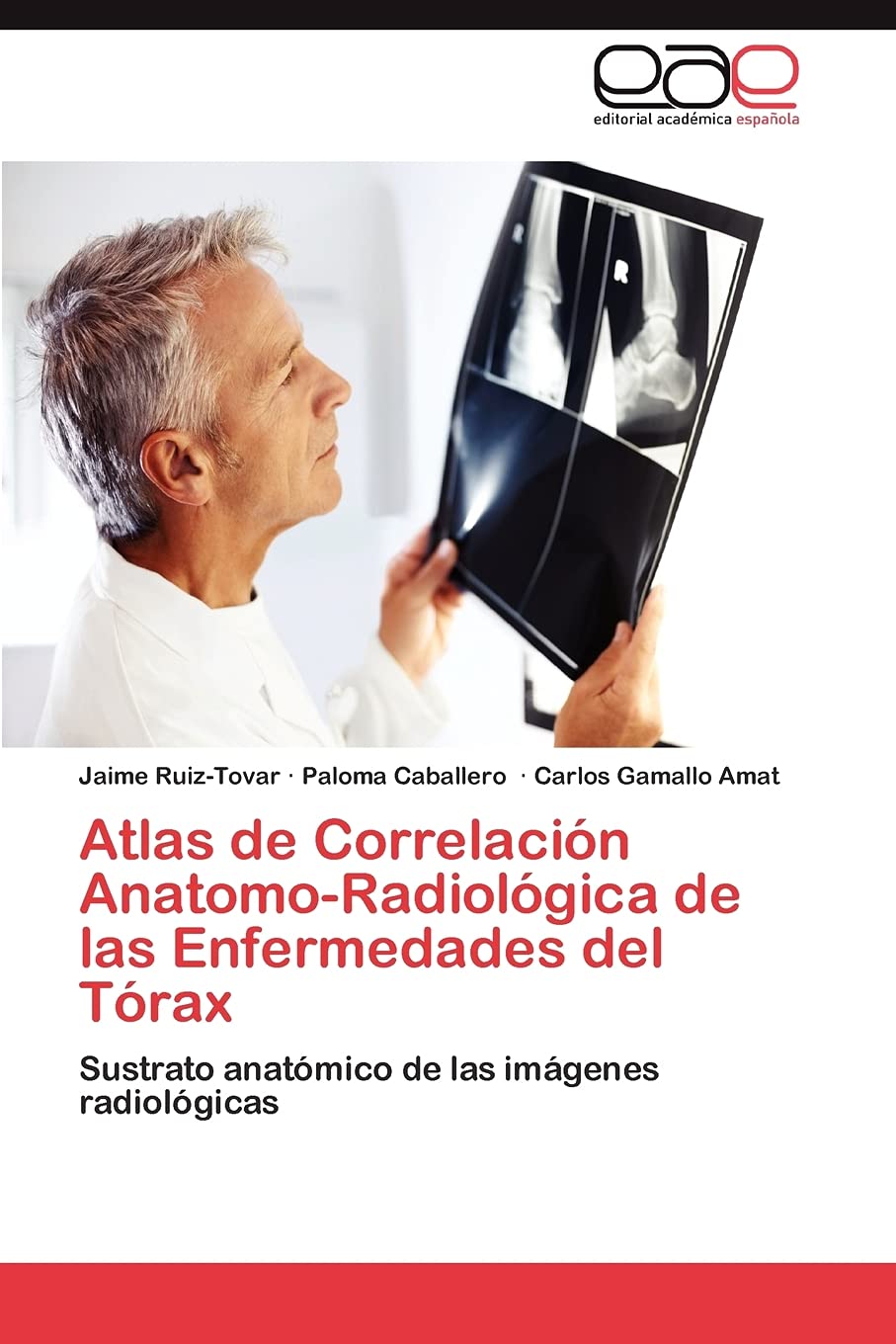 Atlas de Correlacin AnatomoRadiolgica de las Enfermedades del Trax: Sustrato anatmico de las imgenes radiolgicas (S,Used