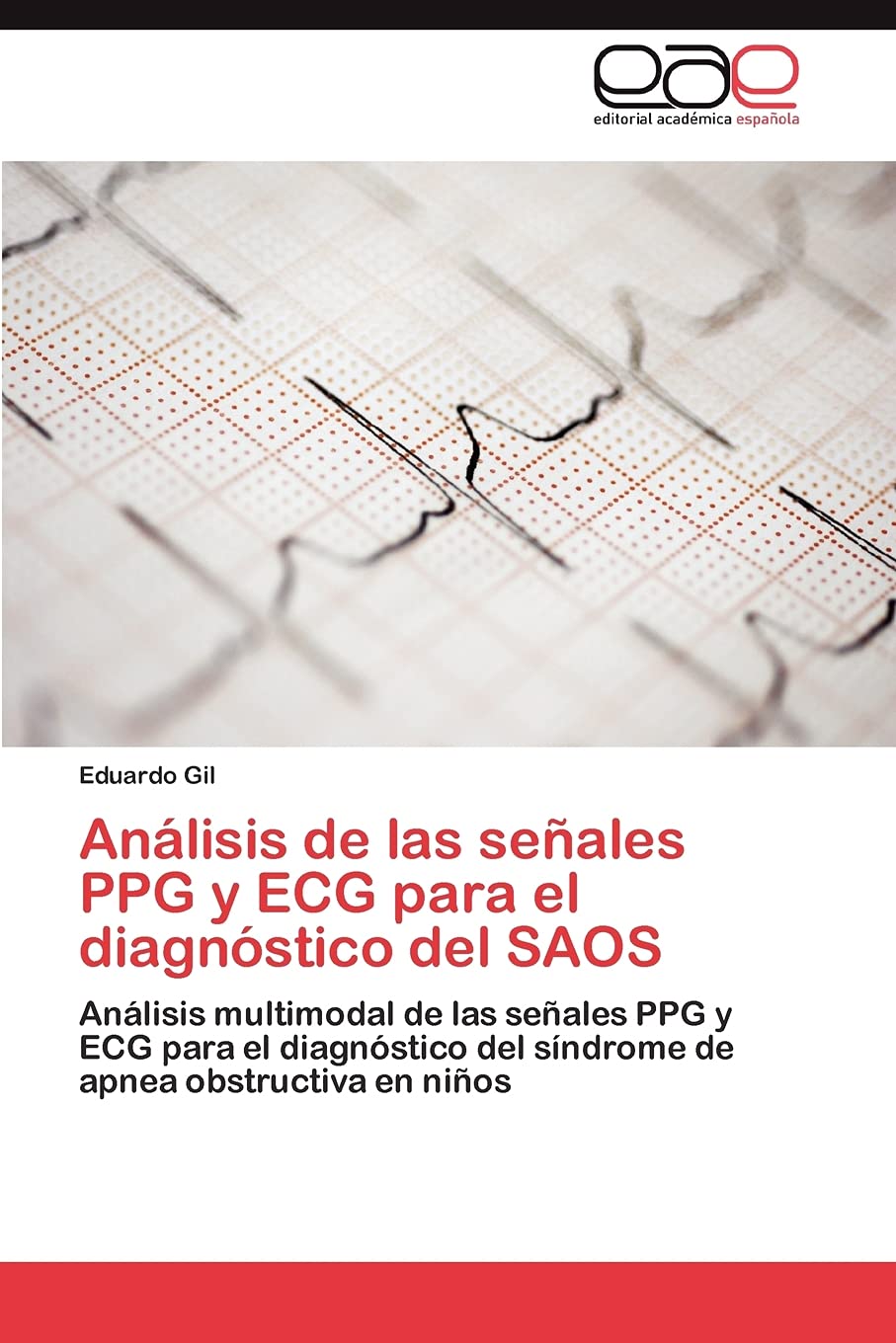 Anlisis de las seales PPG y ECG para el diagnstico del SAOS: Anlisis multimodal de las seales PPG y ECG para el diagnsti,Used