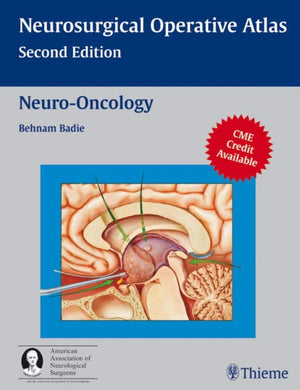 Neurooncology (Aan)