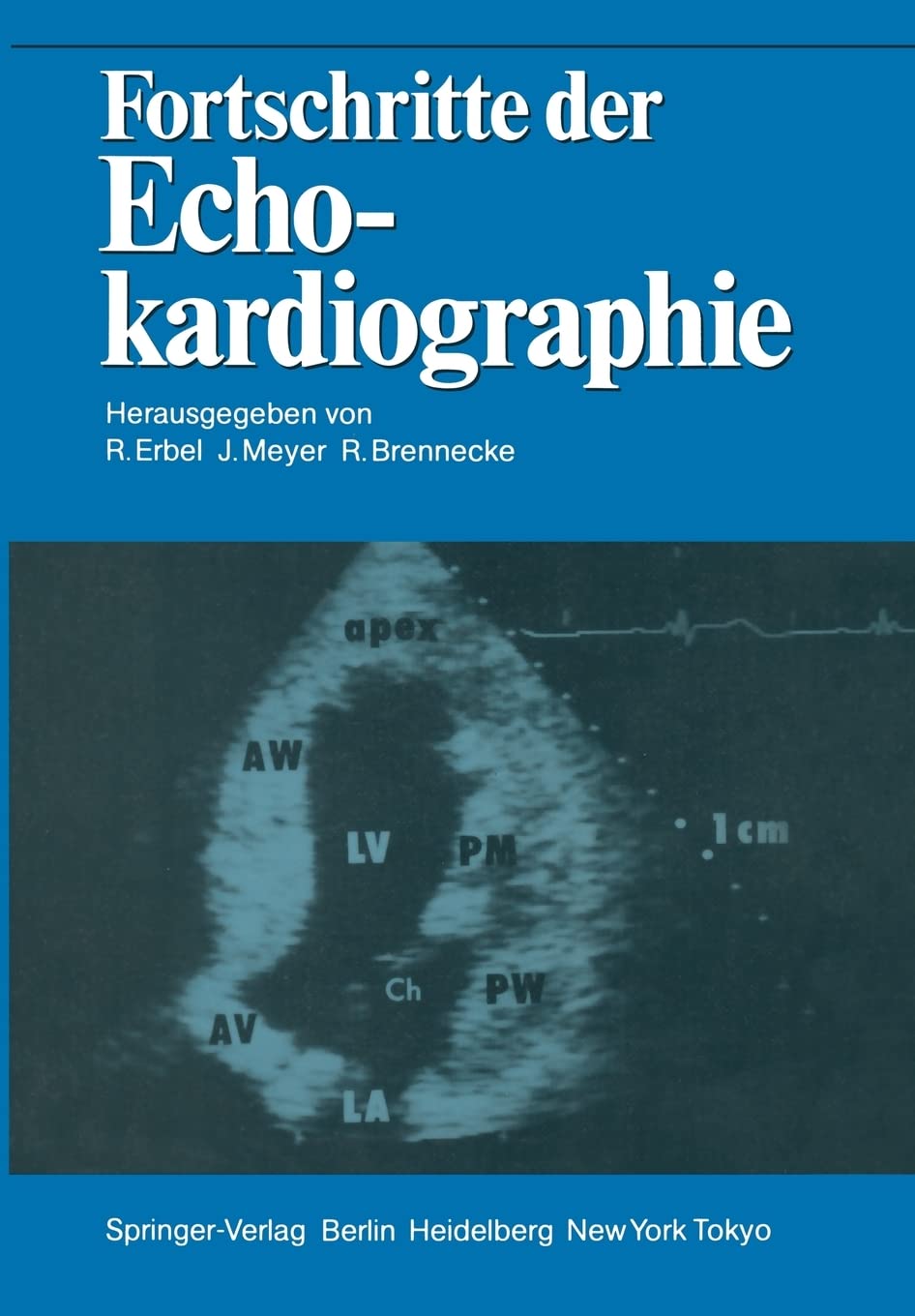 Fortschritte der Echokardiographie (German Edition),Used