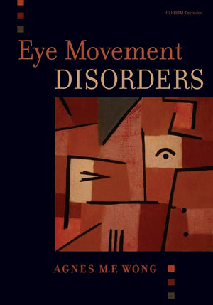 Eye Movement Disorders