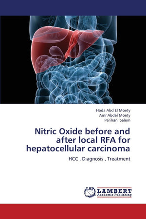 Nitric Oxide before and after local RFA for hepatocellular carcinoma: HCC , Diagnosis , Treatment,Used