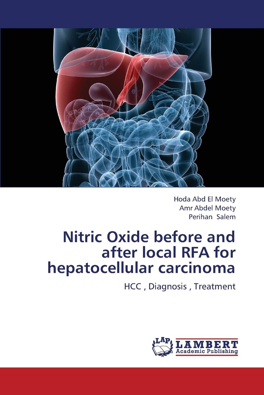 Nitric Oxide before and after local RFA for hepatocellular carcinoma: HCC , Diagnosis , Treatment,Used