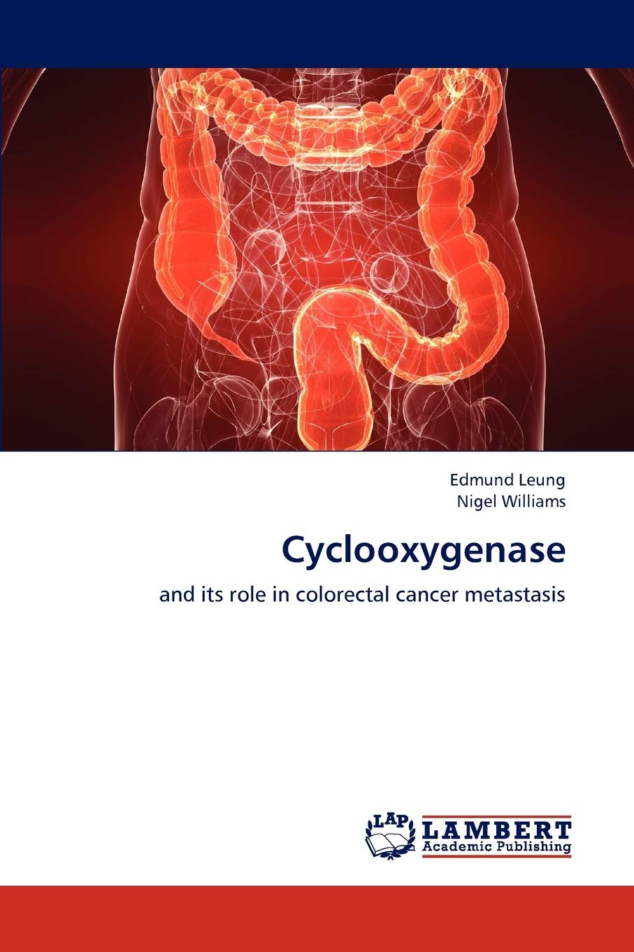 Cyclooxygenase: and its role in colorectal cancer metastasis,Used