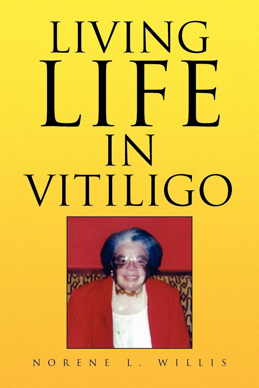Living Life In Vitiligo,Used