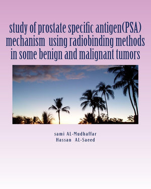 study of prostate specific antigen(PSA) mechanism using radiobinding methods in some benign and malignant tumors: PSA in tumors,Used