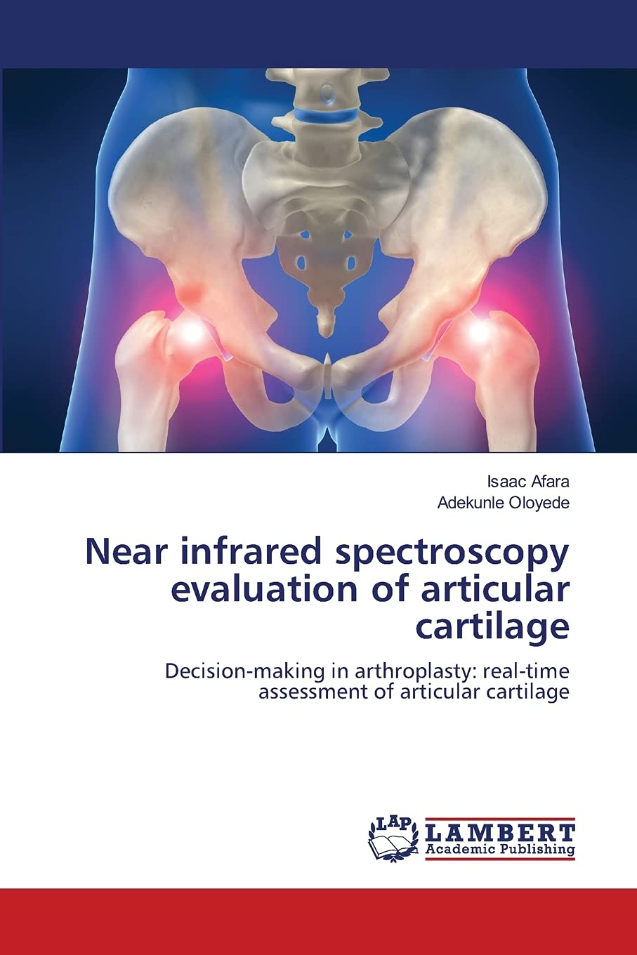 Near infrared spectroscopy evaluation of articular cartilage: Decisionmaking in arthroplasty: realtime assessment of articular,Used