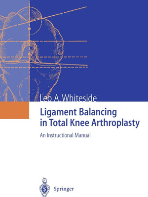 Ligament Balancing In Total Knee Arthroplasty: An Instructional Manual,Used