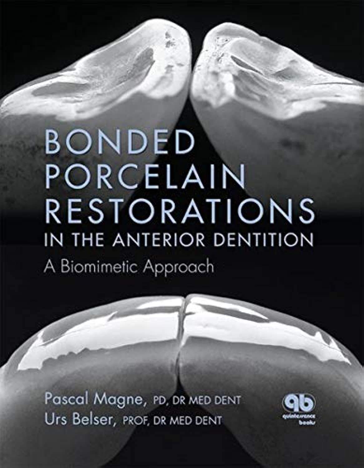 Bonded Porcelain Restorations in the Anterior Dentition: A Biomimetic Approach