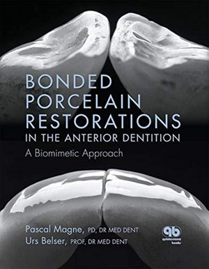 Bonded Porcelain Restorations in the Anterior Dentition: A Biomimetic Approach