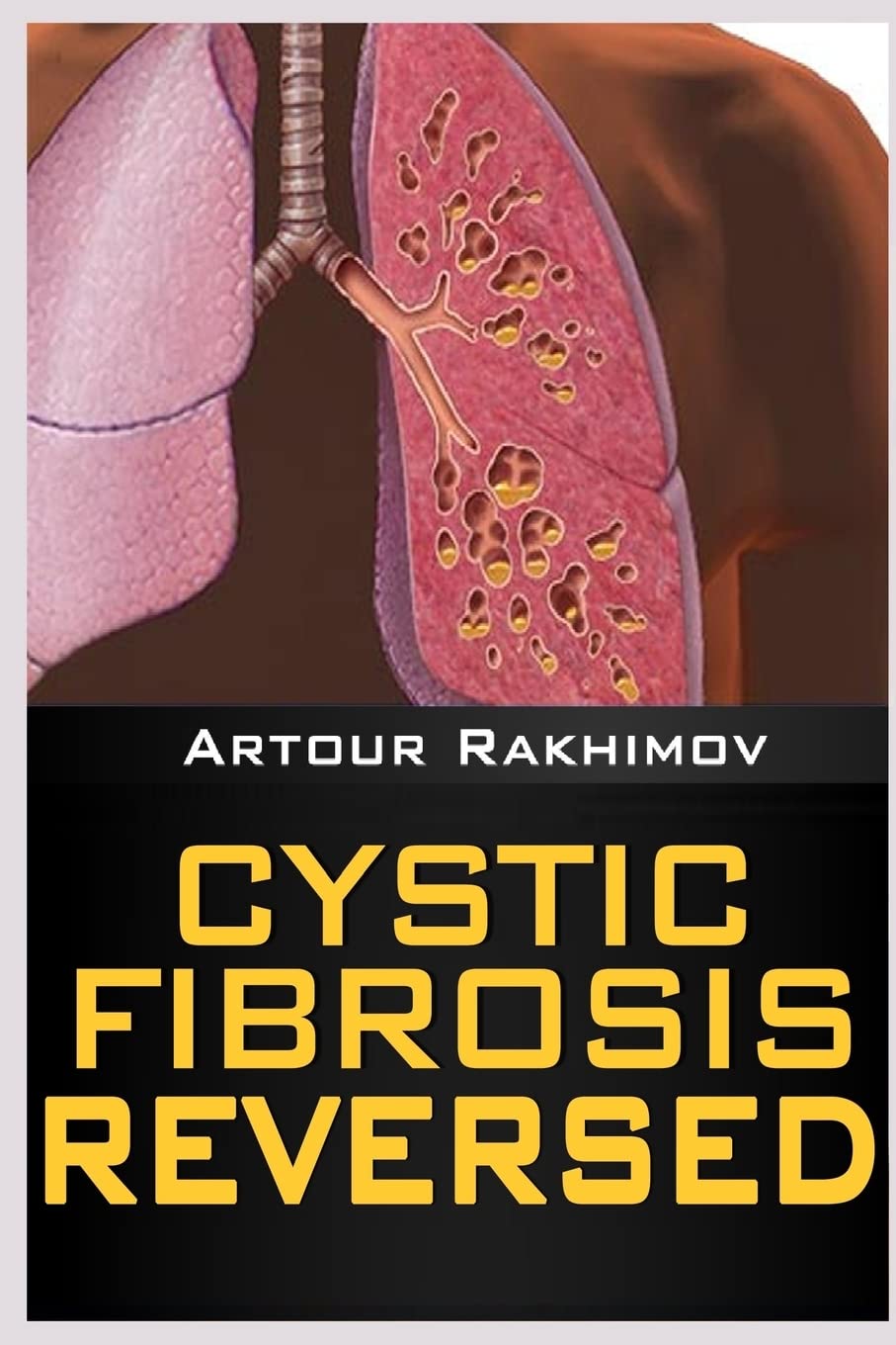 Cystic Fibrosis Reversed,Used