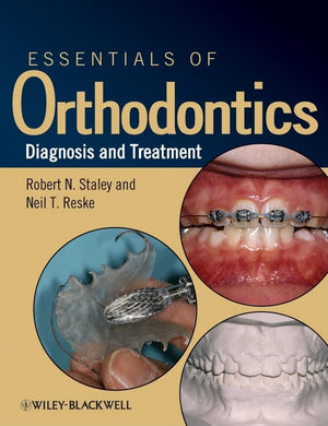 Essentials Of Orthodontics: Diagnosis And Treatment,Used