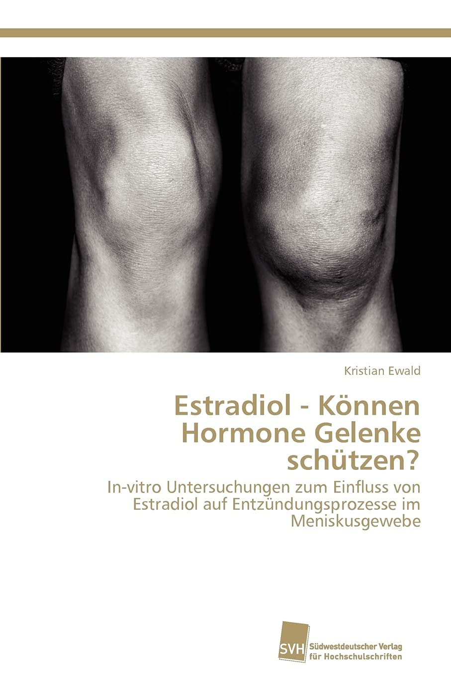 Estradiol  Knnen Hormone Gelenke schtzen?: Invitro Untersuchungen zum Einfluss von Estradiol auf Entzndungsprozesse im Menisku,Used