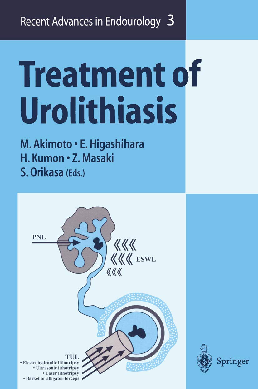 Treatment of Urolithiasis,Used