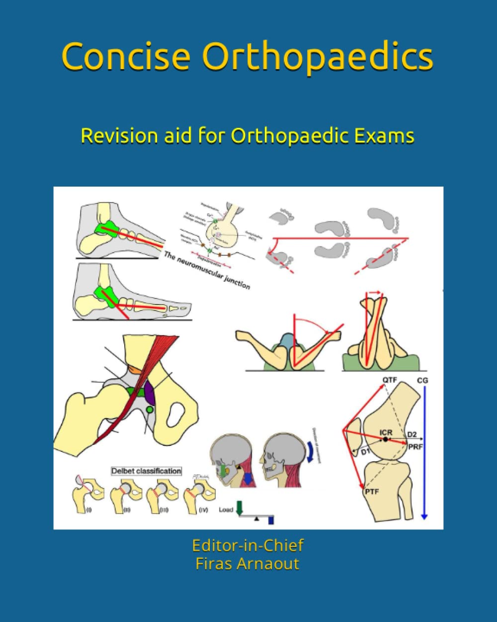 Concise Orthopaedic Notes: Revision aid for FRCS , EBOT , SICOT and Board Examinations (Concise Orthopaedics),Used