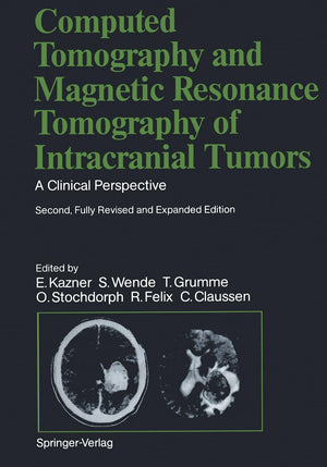 Computed Tomography And Magnetic Resonance Tomography Of Intracranial Tumors: A Clinical Perspective,Used