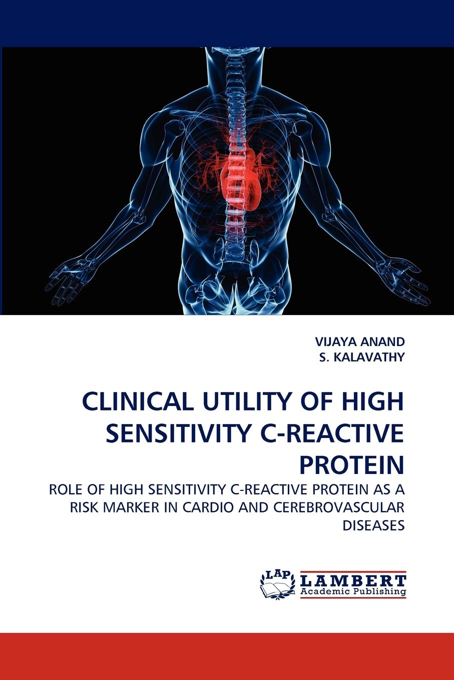 CLINICAL UTILITY OF HIGH SENSITIVITY CREACTIVE PROTEIN: ROLE OF HIGH SENSITIVITY CREACTIVE PROTEIN AS A RISK MARKER IN CARDIO ,Used