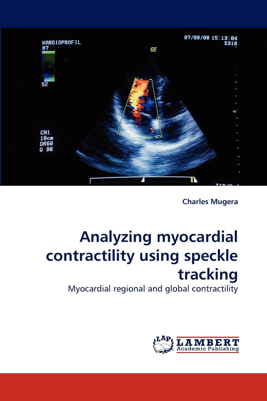 Analyzing myocardial contractility using speckle tracking: Myocardial regional and global contractility,Used