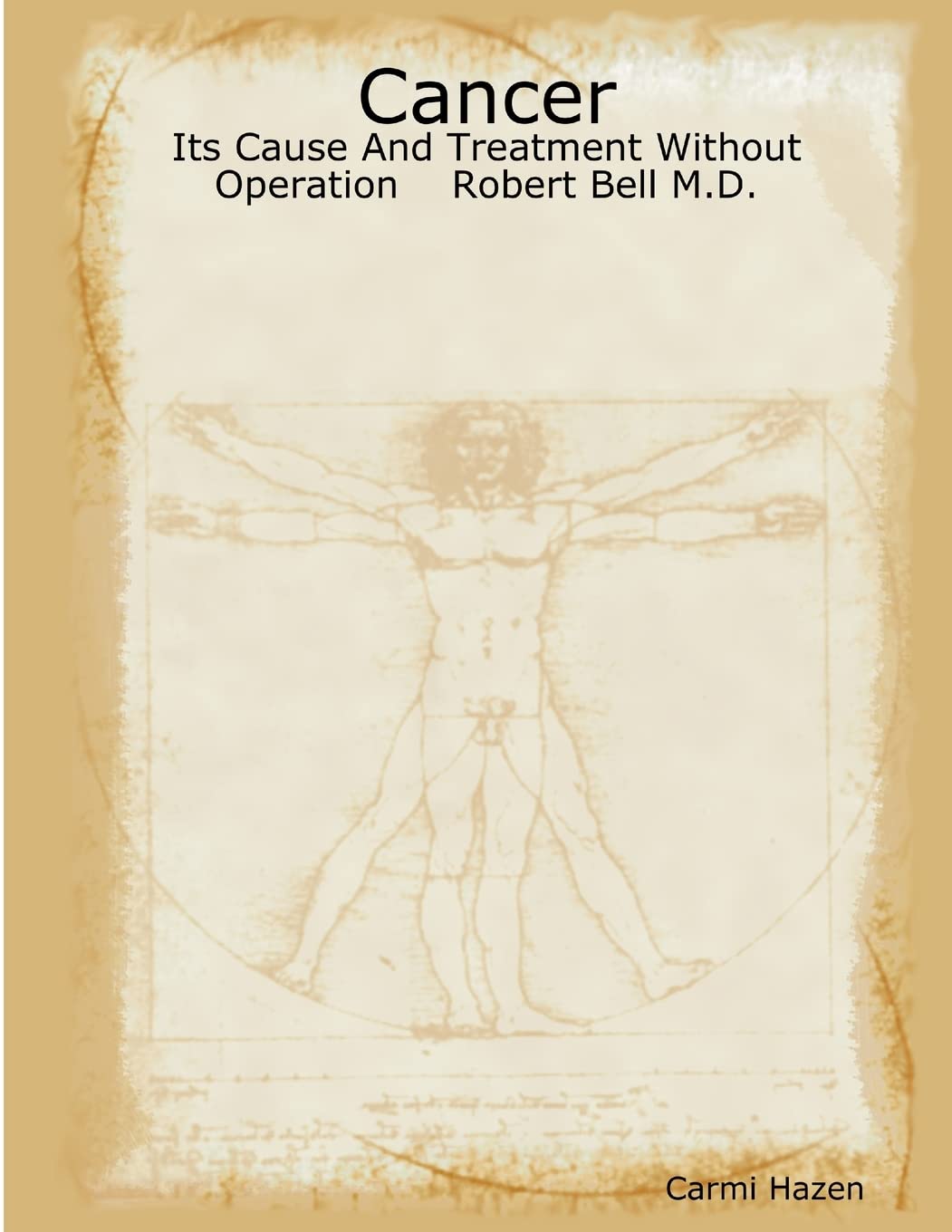 Cancer: Its Cause And Treatment Without Operation Robert Bell M.D.,Used