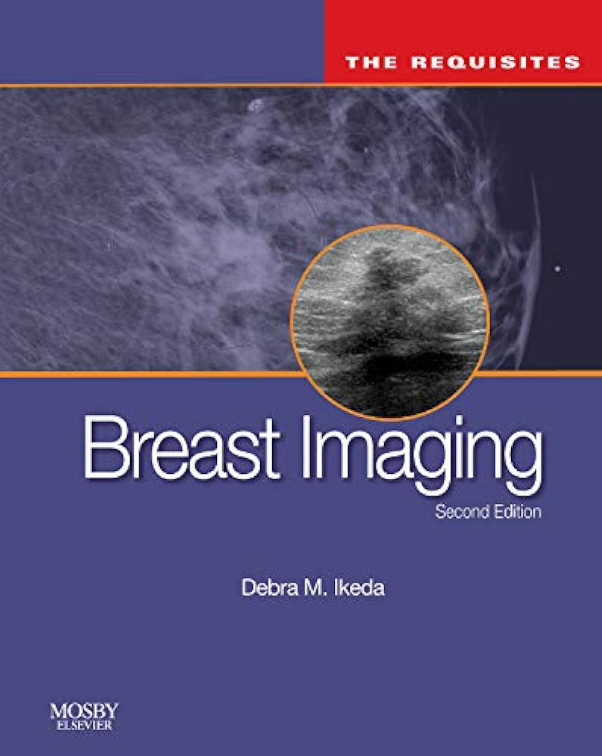 Breast Imaging (The Core Requisites),Used