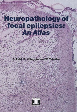 Neuropathology Of Focal Epilepsies: An Atlas,Used