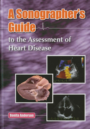 Sonographer's Guide to the Assessment of Heart Disease,Used