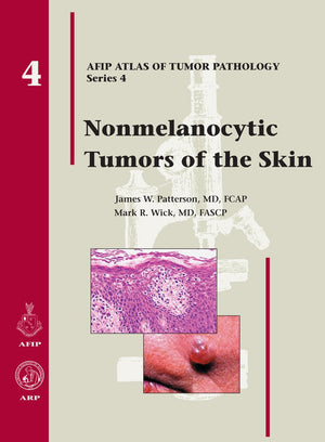 Nonmelanocytic Tumors of the Skin (Atlas of Tumor Pathology Series IV),Used