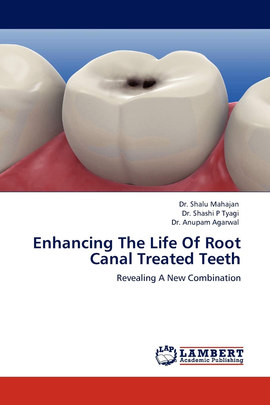 Enhancing The Life Of Root Canal Treated Teeth: Revealing A New Combination,Used