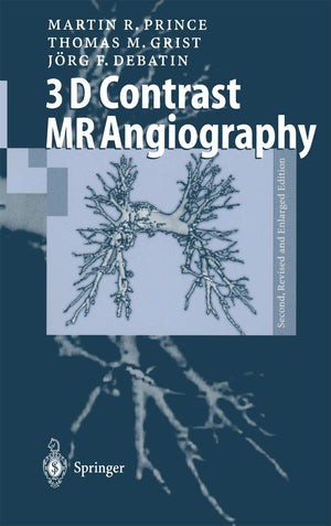 3D Contrast MR Angiography,Used