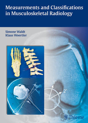 Measurements And Classifications In Musculoskeletal Radiology,Used
