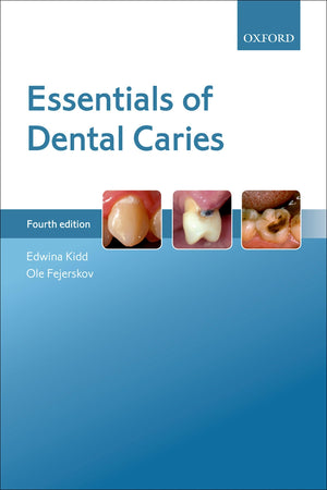 Essentials Of Dental Caries,New