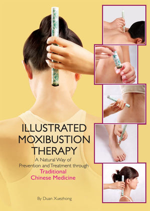 Illustrated Moxibustion Therapy: A Natural Way of Prevention and Treatment through Traditional Chinese Medicine,Used