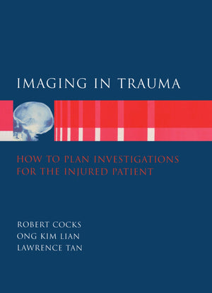 Imaging in Trauma: How to Plan Investigations for the Injured Patient,Used