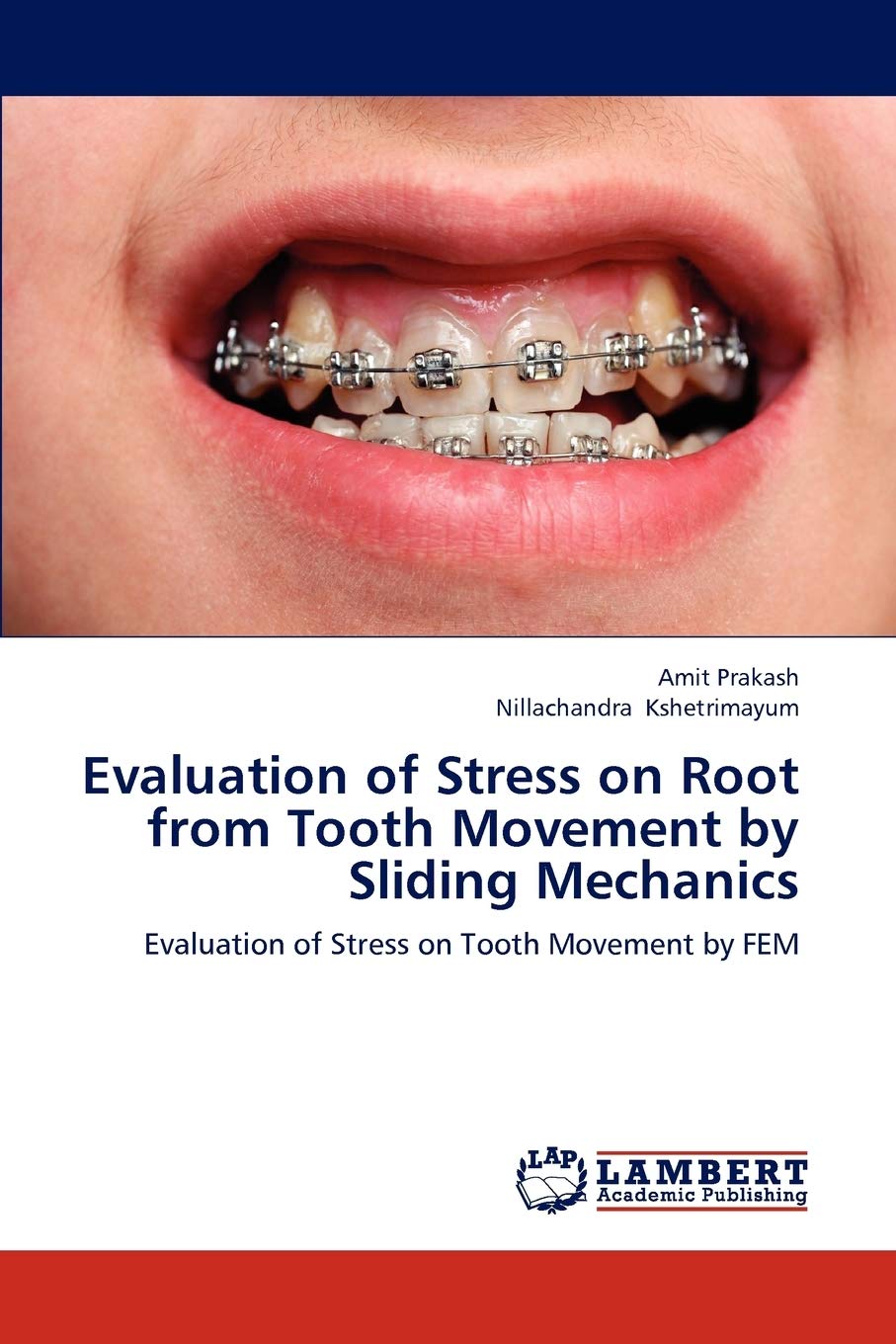 Evaluation of Stress on Root from Tooth Movement by Sliding Mechanics: Evaluation of Stress on Tooth Movement by FEM,Used