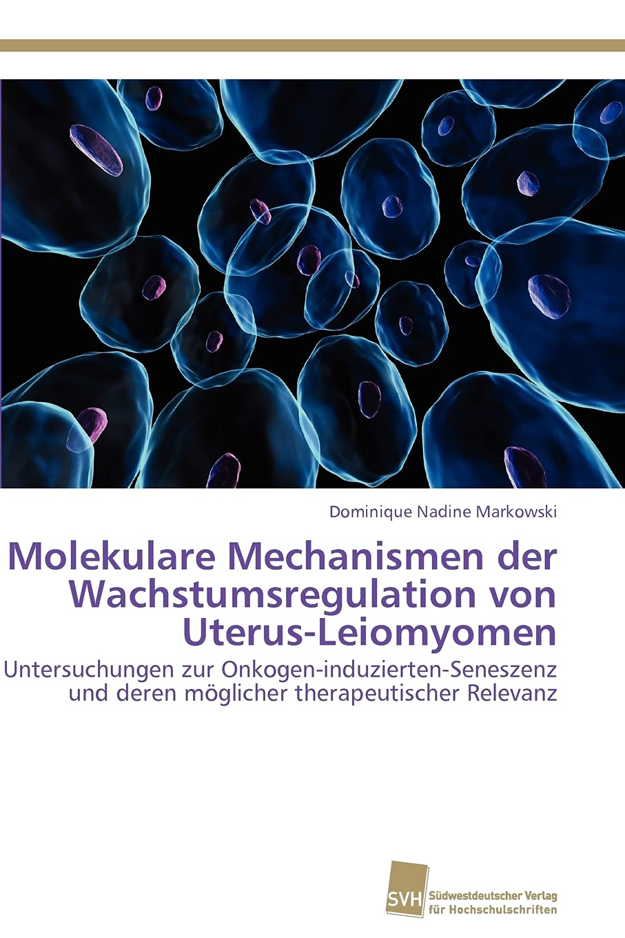 Molekulare Mechanismen der Wachstumsregulation von UterusLeiomyomen: Untersuchungen zur OnkogeninduziertenSeneszenz und deren,Used