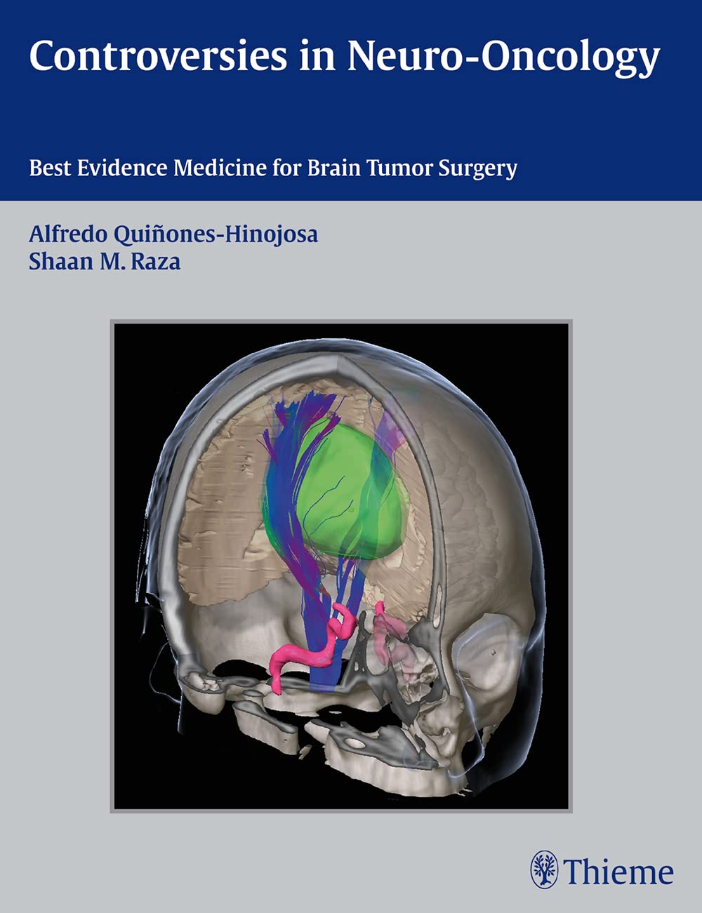 Controversies In Neurooncology: Best Evidence Medicine For Brain Tumor Surgery,Used