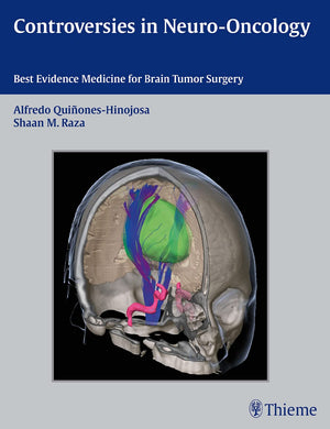 Controversies In Neurooncology: Best Evidence Medicine For Brain Tumor Surgery,Used