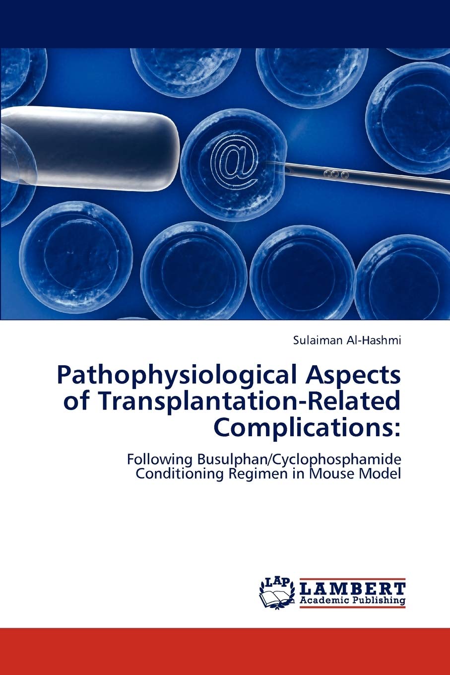 Pathophysiological Aspects of TransplantationRelated Complications:: Following Busulphan/Cyclophosphamide Conditioning Regimen ,Used