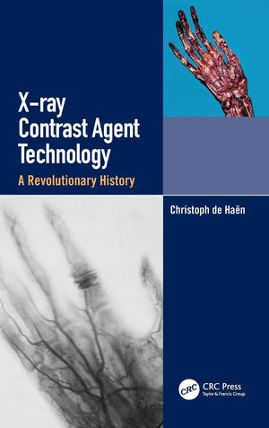 Xray Contrast Agent Technology: A Revolutionary History,Used